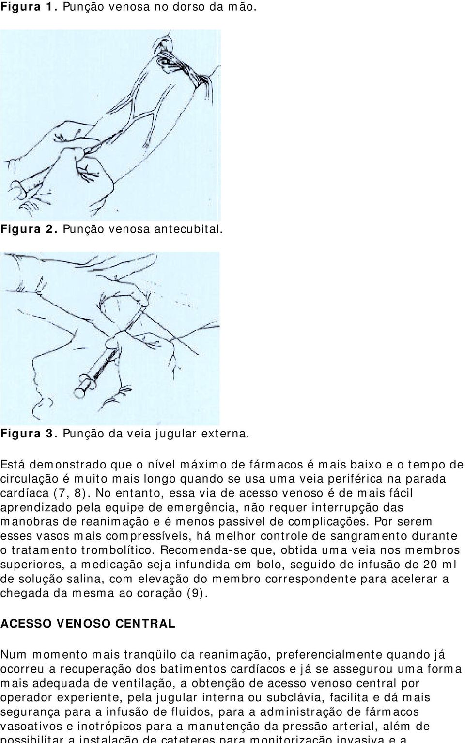 No entanto, essa via de acesso venoso é de mais fácil aprendizado pela equipe de emergência, não requer interrupção das manobras de reanimação e é menos passível de complicações.