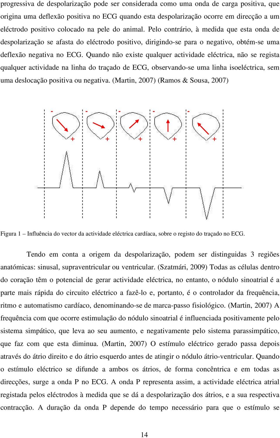 Quando não existe qualquer actividade eléctrica, não se regista qualquer actividade na linha do traçado de ECG, observando-se uma linha isoeléctrica, sem uma deslocação positiva ou negativa.