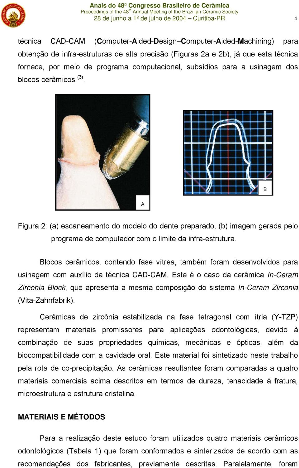 B A Figura 2: (a) escaneamento do modelo do dente preparado, (b) imagem gerada pelo programa de computador com o limite da infra-estrutura.