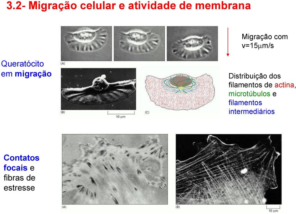 Distribuição dos filamentos de actina, microtúbulos