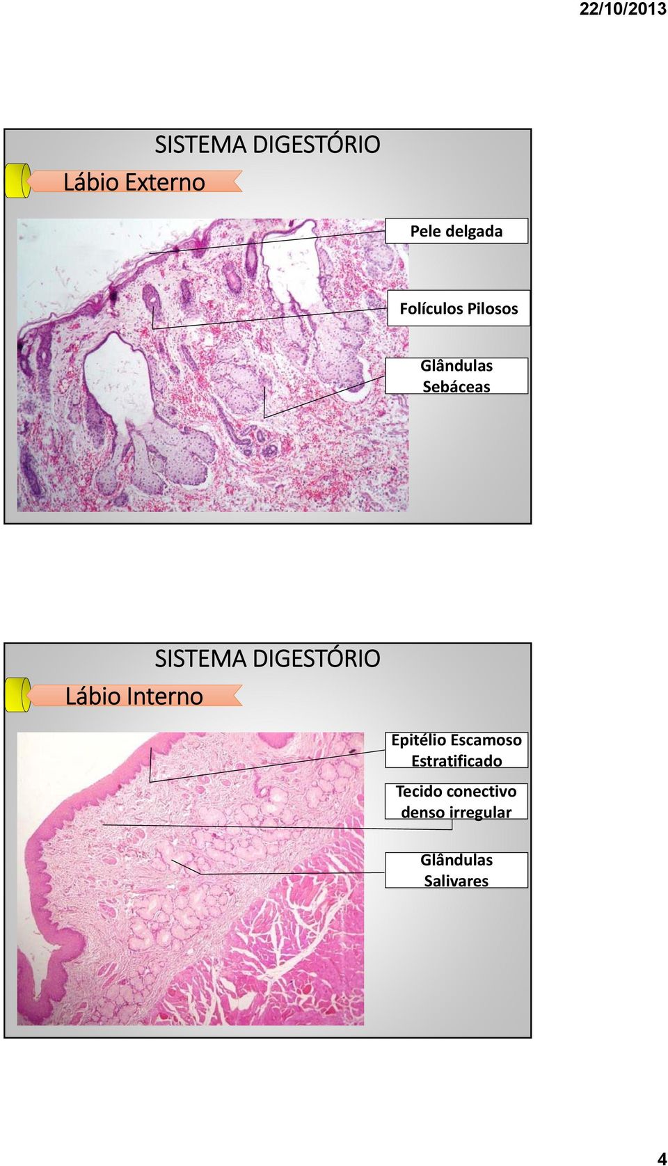 Epitélio Escamoso Estratificado Tecido