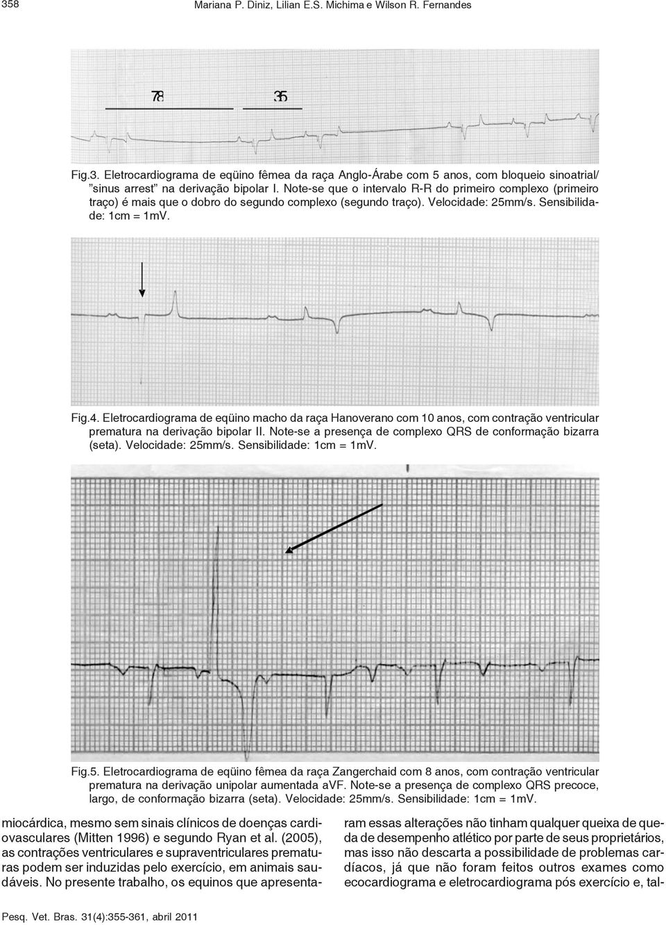 Eletrocardiograma de eqüino macho da raça Hanoverano com 10 anos, com contração ventricular prematura na derivação bipolar II. Note-se a presença de complexo QRS de conformação bizarra (seta).