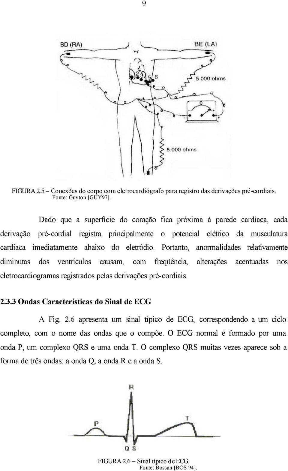 Portanto, anormalidades relativamente diminutas dos ventrículos causam, com freqüência, alterações acentuadas nos eletrocardiogramas registrados pelas derivações pré-cordiais. 2.3.