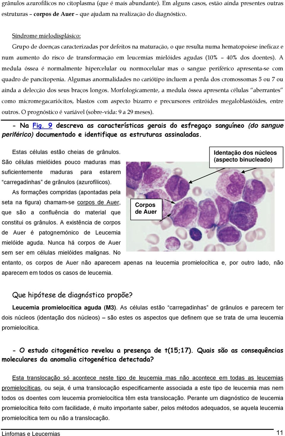 (10% 40% dos doentes). A medula óssea é normalmente hipercelular ou normocelular mas o sangue periférico apresenta-se com quadro de pancitopenia.