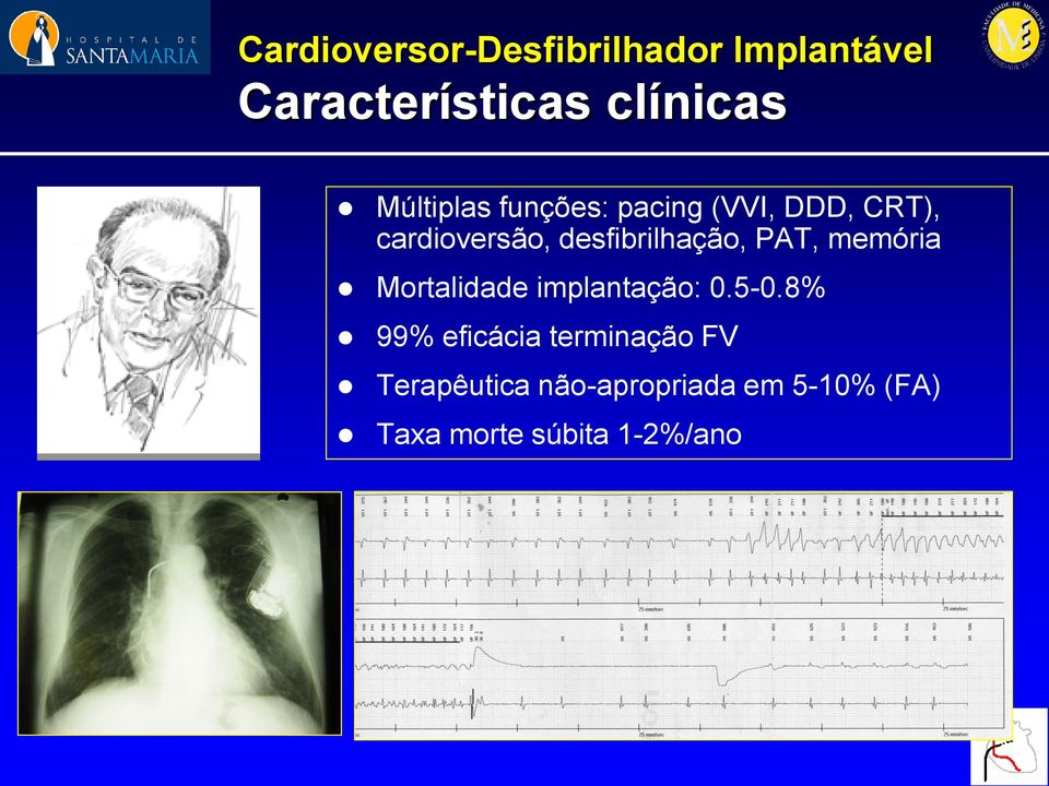 desfibrilhação, PAT, memória Mortalidade implantação: 0.5-0.
