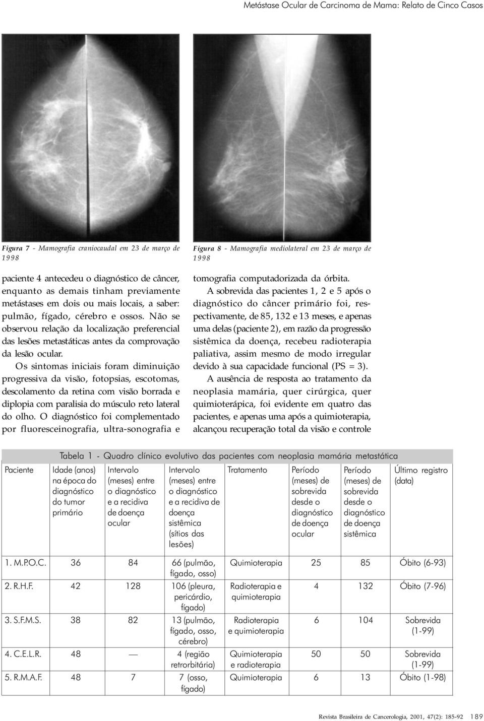 Não se observou relação da localização preferencial das lesões metastáticas antes da comprovação da lesão ocular.