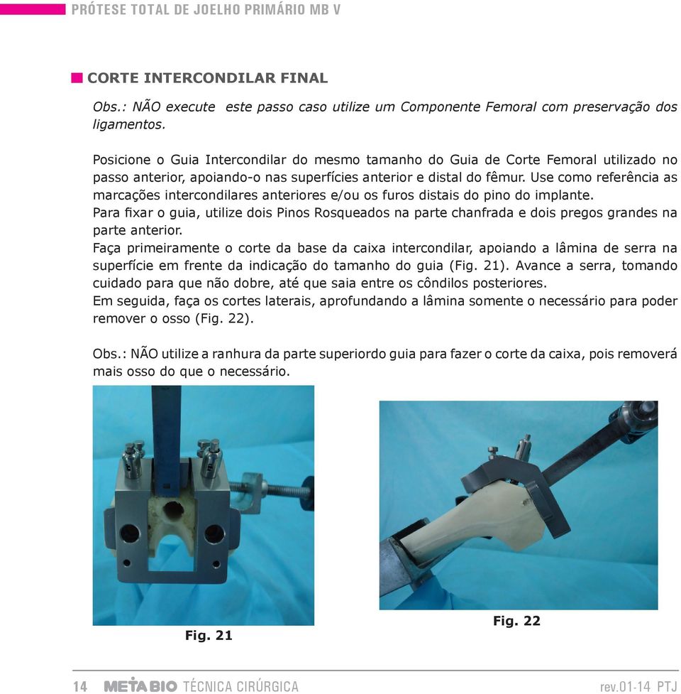 Use como referência as marcações intercondilares anteriores e/ou os furos distais do pino do implante.