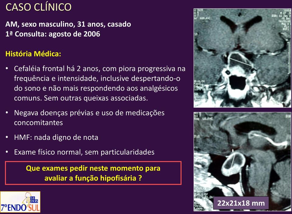 analgésicos comuns. Sem outras queixas associadas.