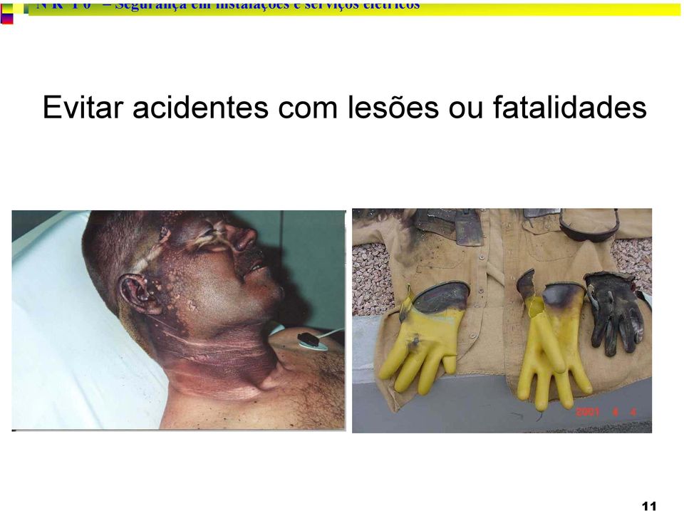 com lesões