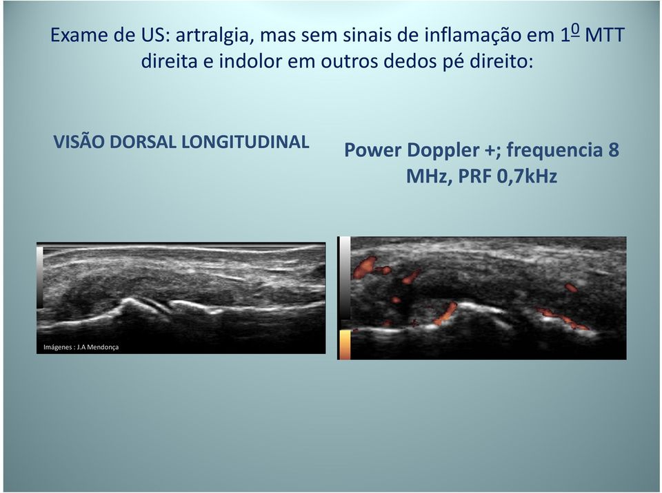 dedos pé direito: VISÃO DORSAL LONGITUDINAL Power