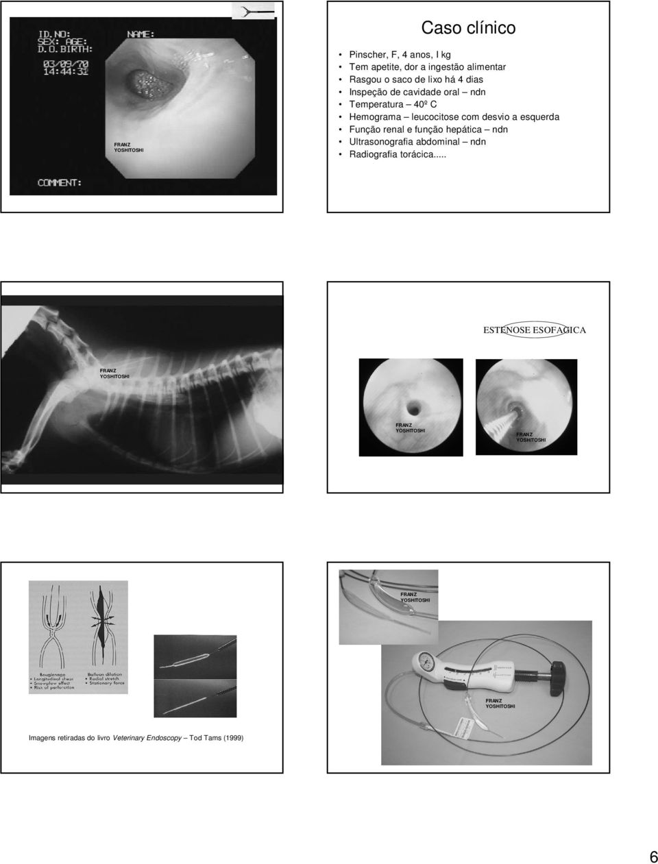 desvio a esquerda Função renal e função hepática ndn Ultrasonografia abdominal ndn