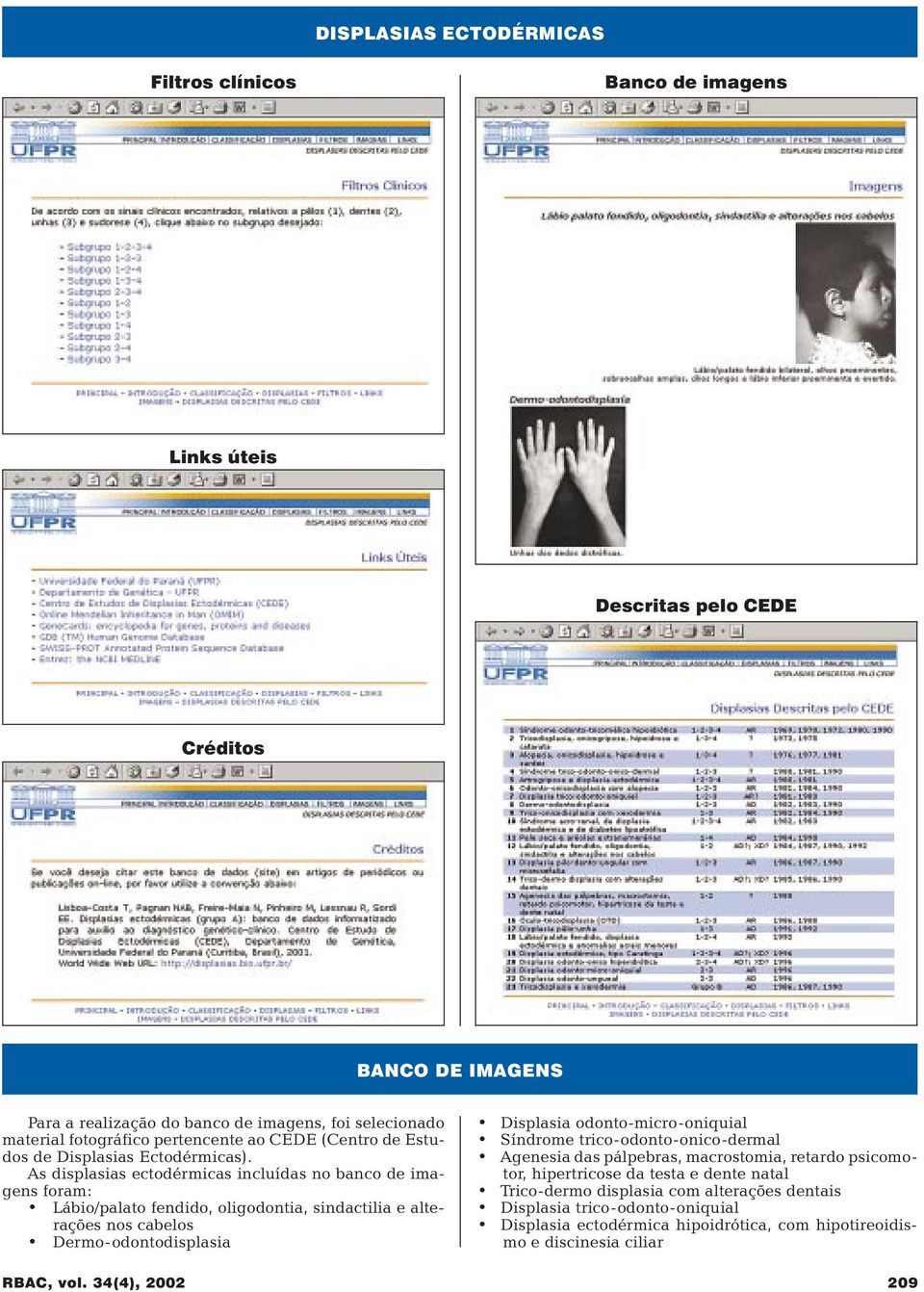 As displasias ectodérmicas incluídas no banco de imagens foram: Lábio/palato fendido, oligodontia, sindactilia e alterações nos cabelos Dermo-odontodisplasia RBAC, vol.