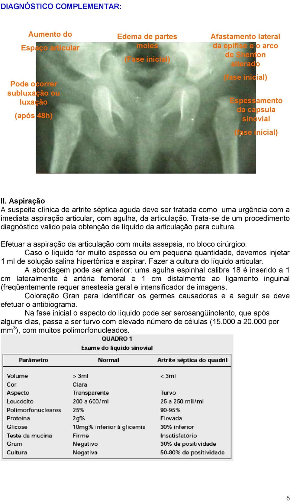 Aspiração A suspeita clínica de artrite séptica aguda deve ser tratada como uma urgência com a imediata aspiração articular, com agulha, da articulação.