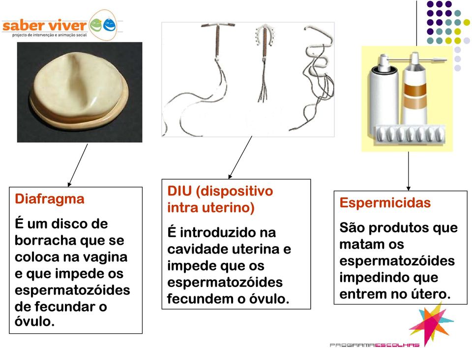 DIU (dispositivo intra uterino) É introduzido na cavidade uterina e impede