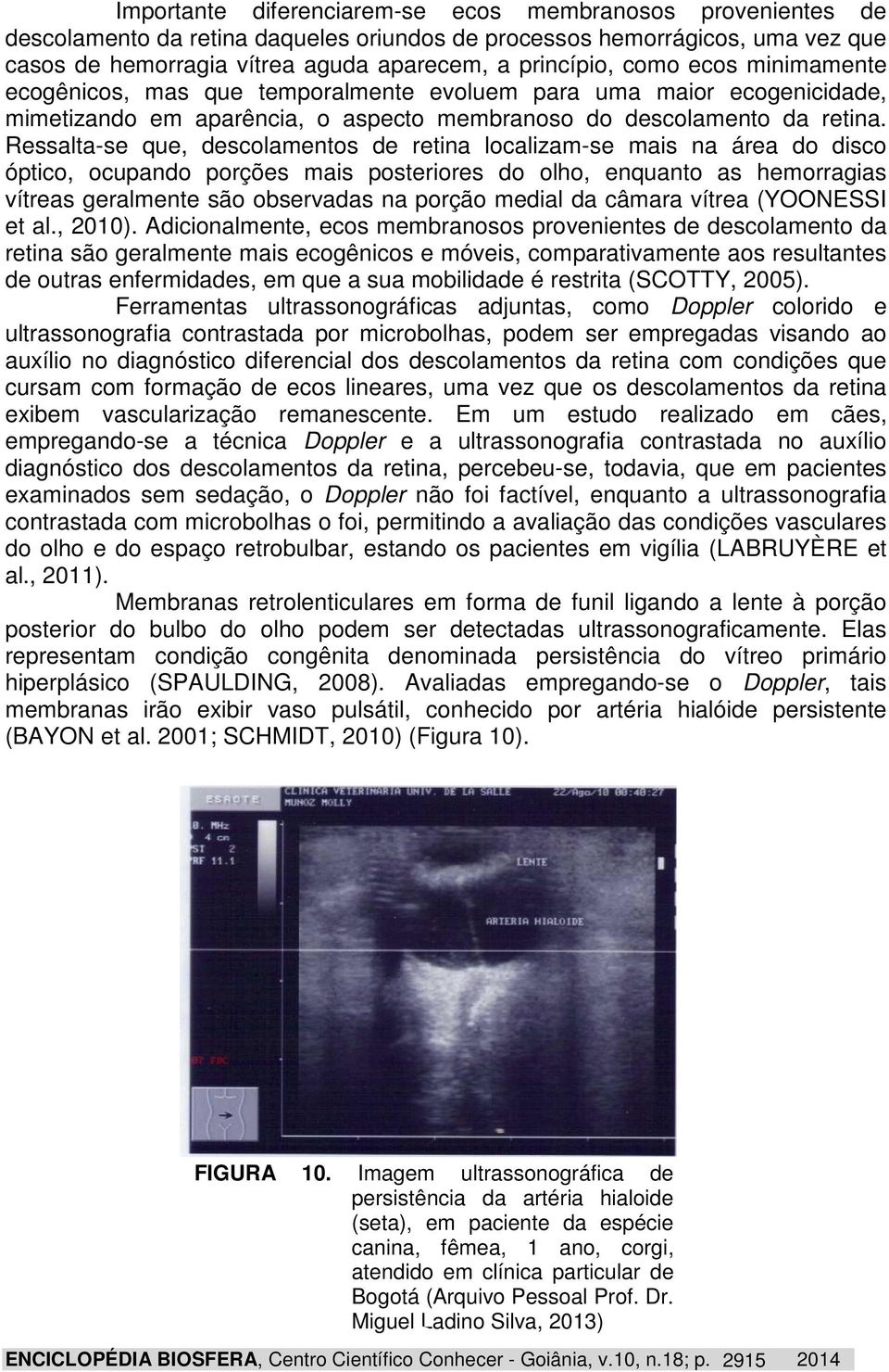 Ressalta-se que, descolamentos de retina localizam-se mais na área do disco óptico, ocupando porções mais posteriores do olho, enquanto as hemorragias vítreas geralmente são observadas na porção