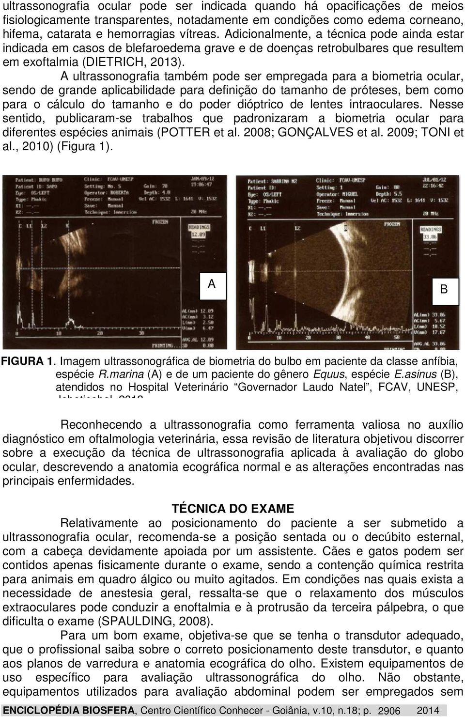 A ultrassonografia também pode ser empregada para a biometria ocular, sendo de grande aplicabilidade para definição do tamanho de próteses, bem como para o cálculo do tamanho e do poder dióptrico de