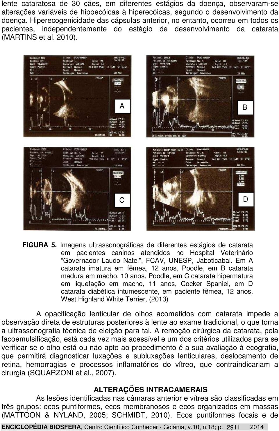 Imagens ultrassonográficas de diferentes estágios de catarata em pacientes caninos atendidos no Hospital Veterinário Governador Laudo Natel, FCAV, UNESP, Jaboticabal.