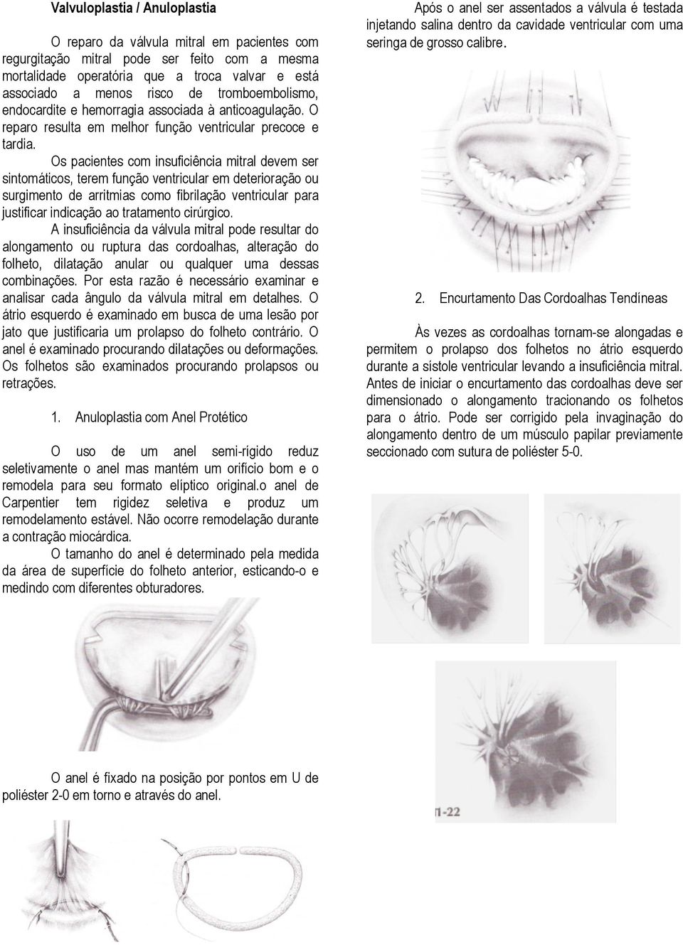 Os pacientes com insuficiência mitral devem ser sintomáticos, terem função ventricular em deterioração ou surgimento de arritmias como fibrilação ventricular para justificar indicação ao tratamento