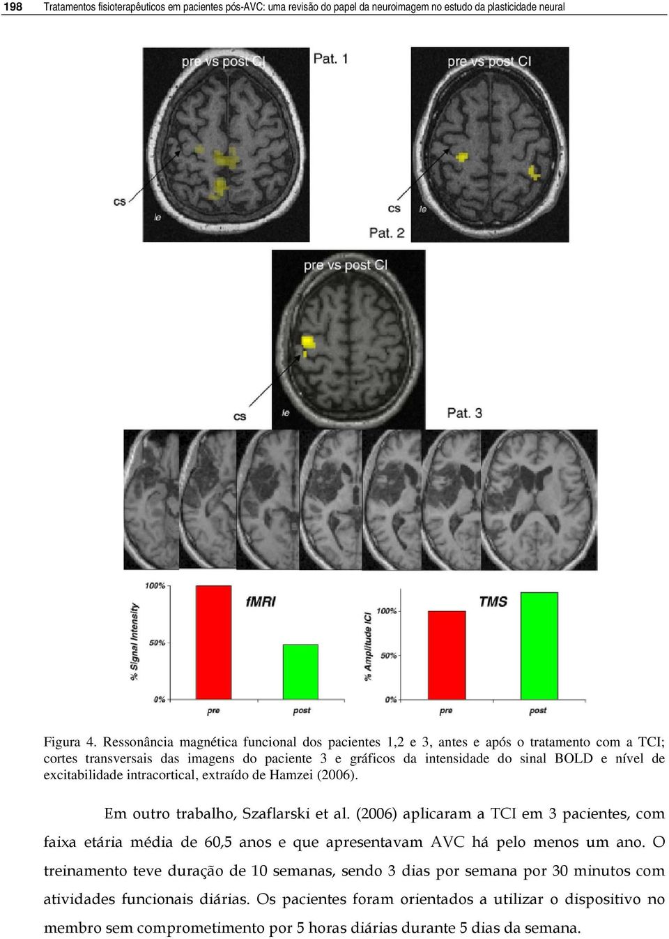 excitabilidade intracortical, extraído de Hamzei (2006). Em outro trabalho, Szaflarski et al.