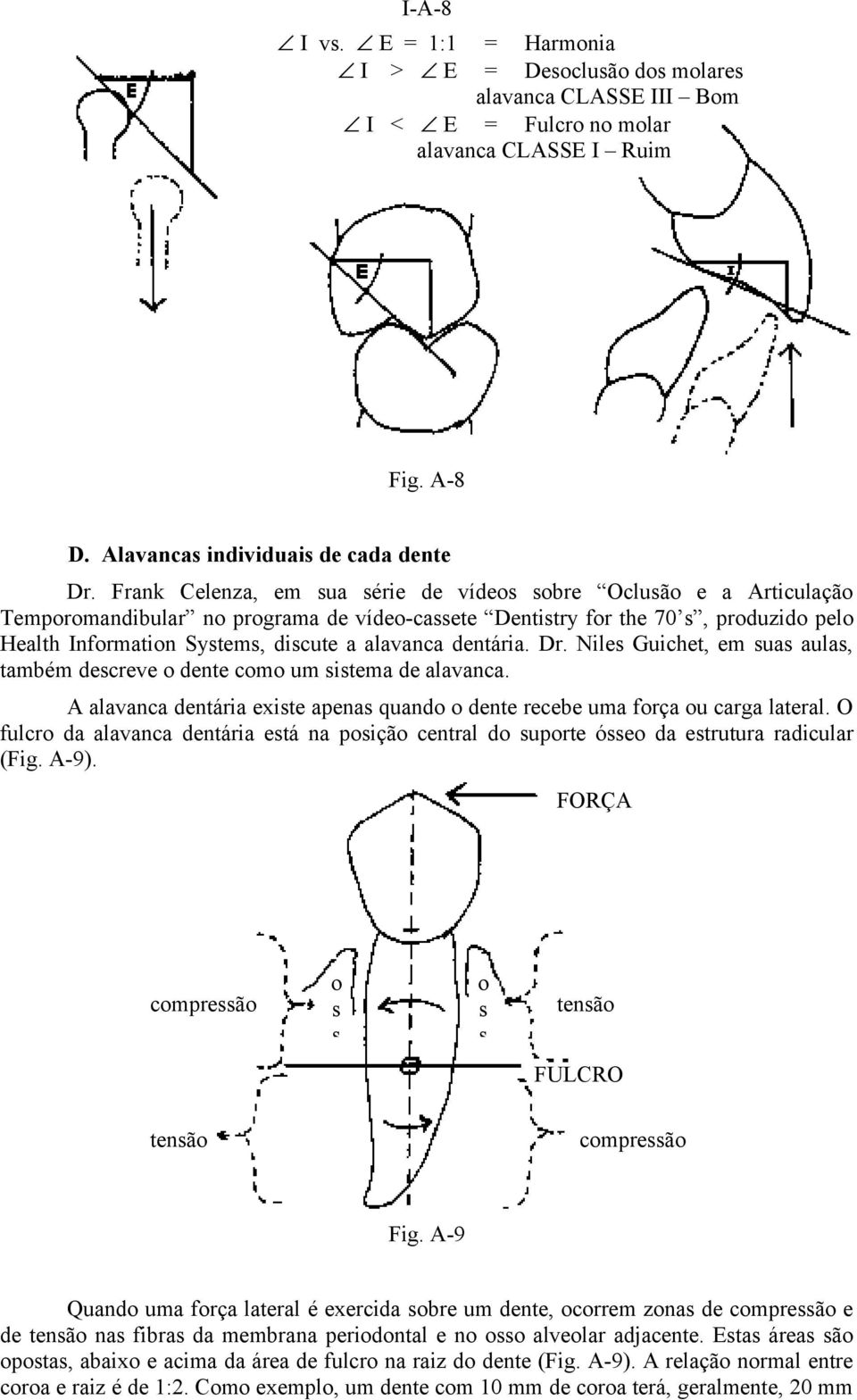 alavanca dentária. Dr. Niles Guichet, em suas aulas, também descreve o dente como um sistema de alavanca. A alavanca dentária existe apenas quando o dente recebe uma força ou carga lateral.