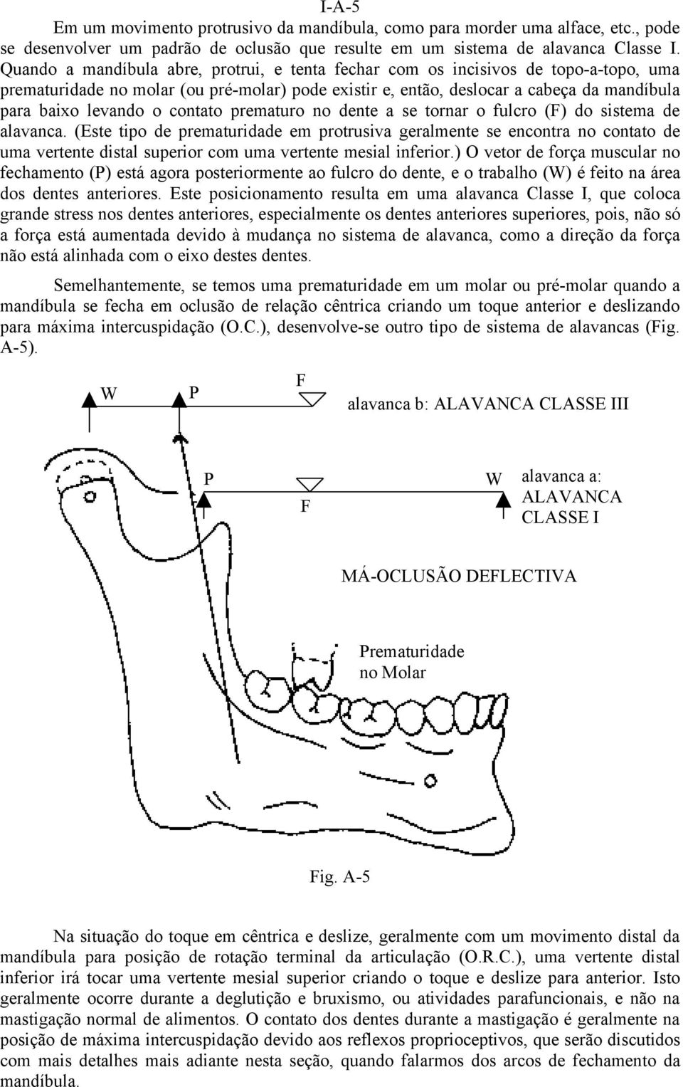 contato prematuro no dente a se tornar o fulcro (F) do sistema de alavanca.