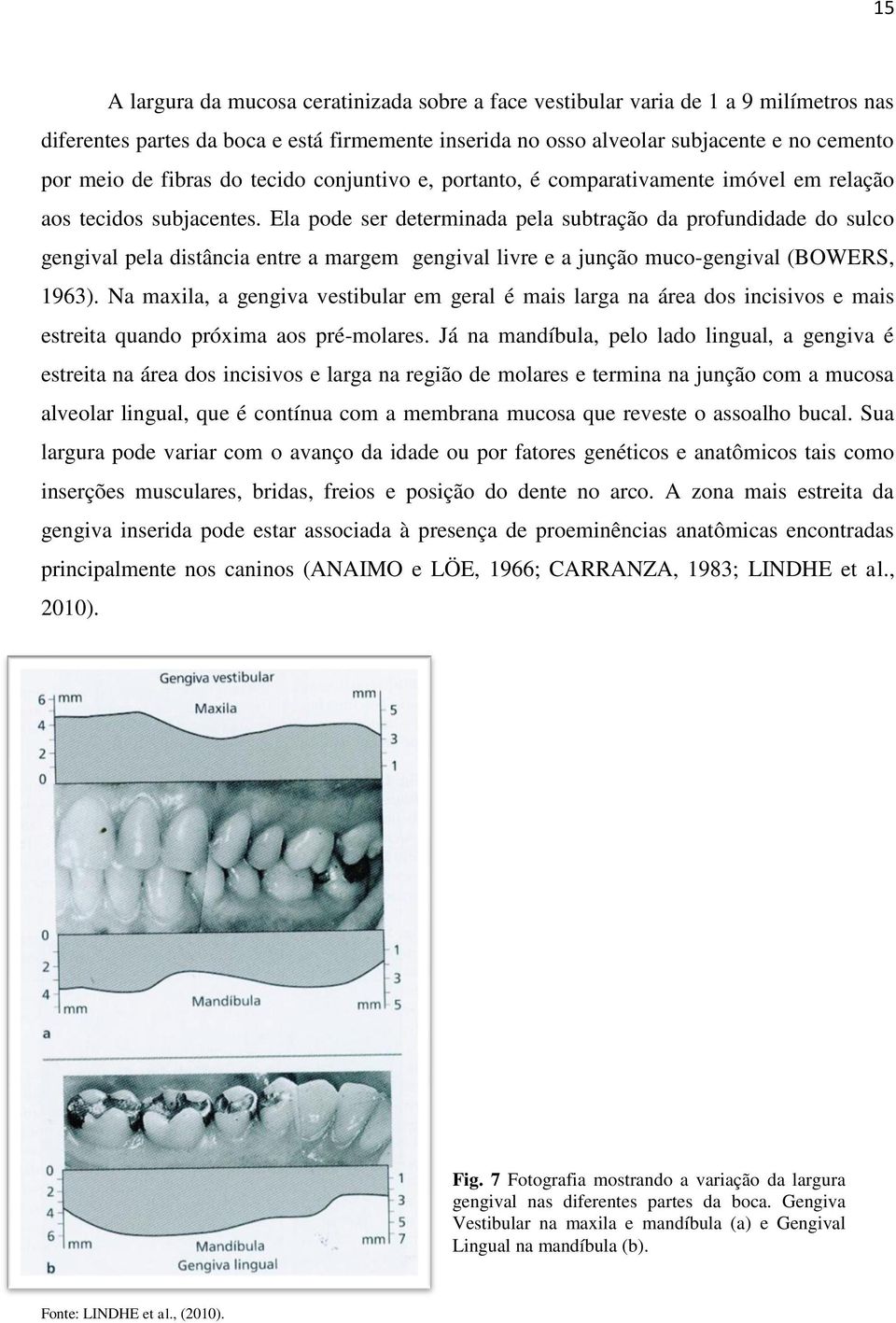 Ela pode ser determinada pela subtração da profundidade do sulco gengival pela distância entre a margem gengival livre e a junção muco-gengival (BOWERS, 1963).