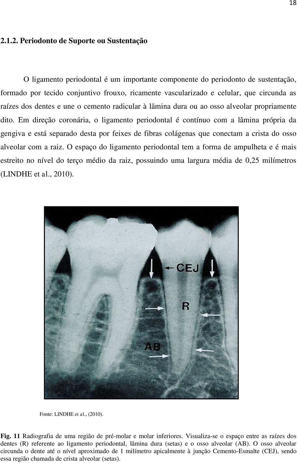 Em direção coronária, o ligamento periodontal é contínuo com a lâmina própria da gengiva e está separado desta por feixes de fibras colágenas que conectam a crista do osso alveolar com a raiz.