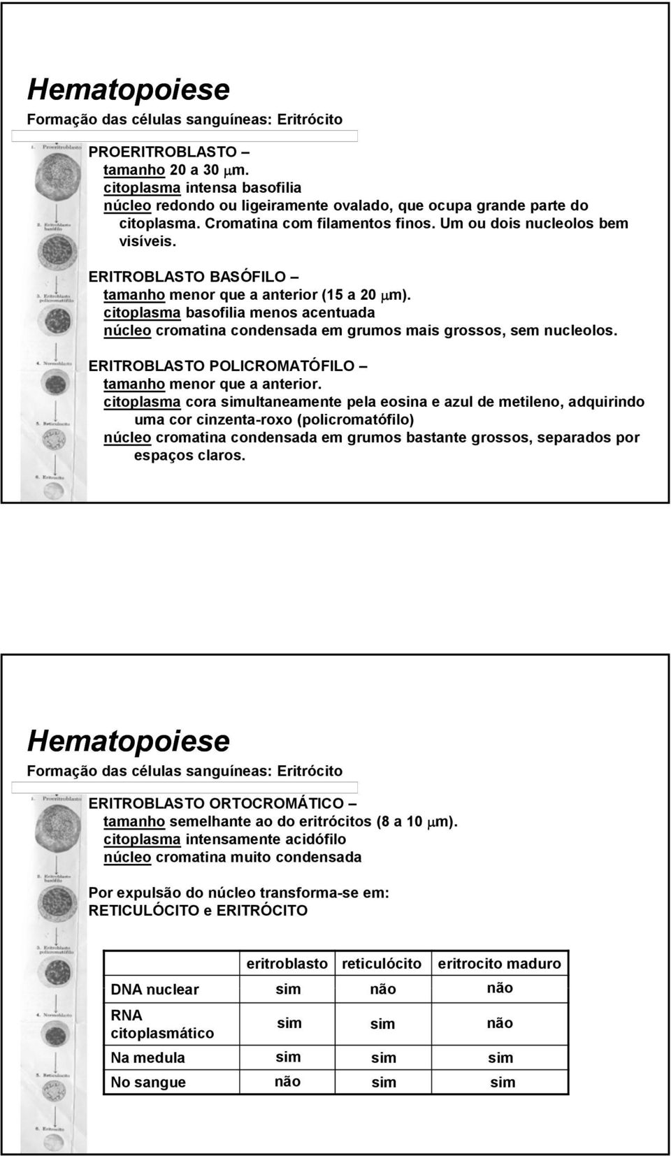 citoplasma basofilia menos acentuada núcleo cromatina condensada em grumos mais grossos, sem nucleolos. ERITROBLASTO POLICROMATÓFILO tamanho menor que a anterior.