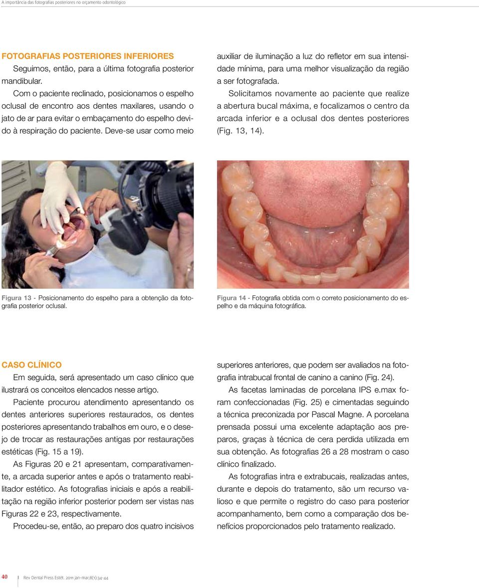 Deve-se usar como meio auxiliar de iluminação a luz do refletor em sua intensidade mínima, para uma melhor visualização da região a ser fotografada.