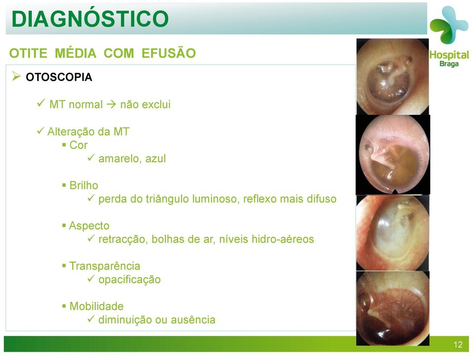 difuso Aspecto retracção, bolhas de ar, níveis hidro-aéreos