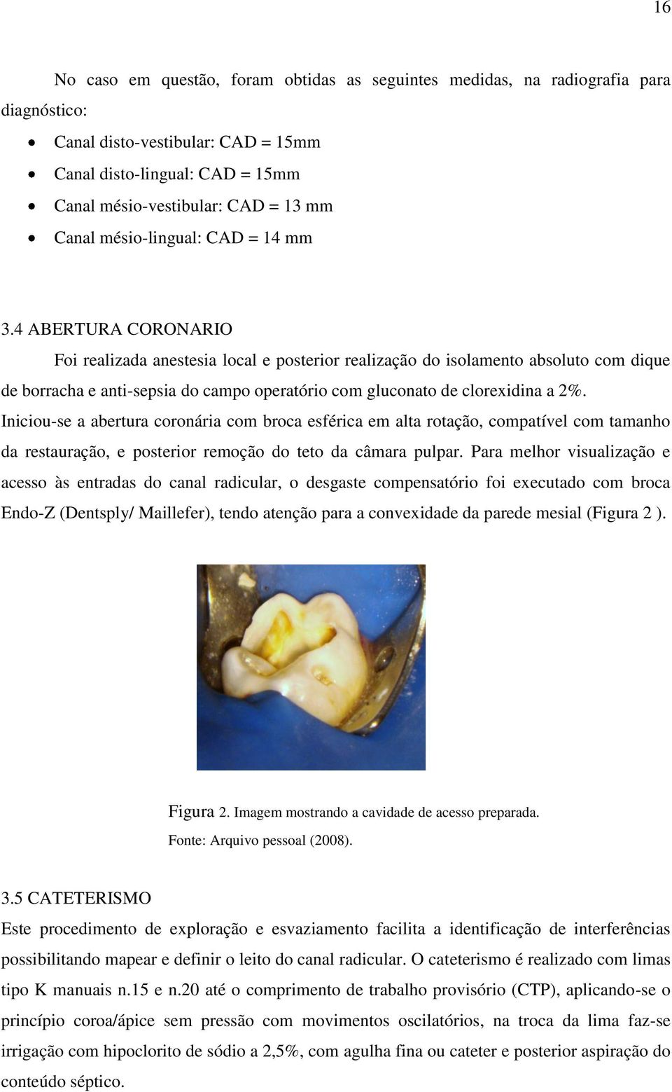 4 ABERTURA CORONARIO Foi realizada anestesia local e posterior realização do isolamento absoluto com dique de borracha e anti-sepsia do campo operatório com gluconato de clorexidina a 2%.