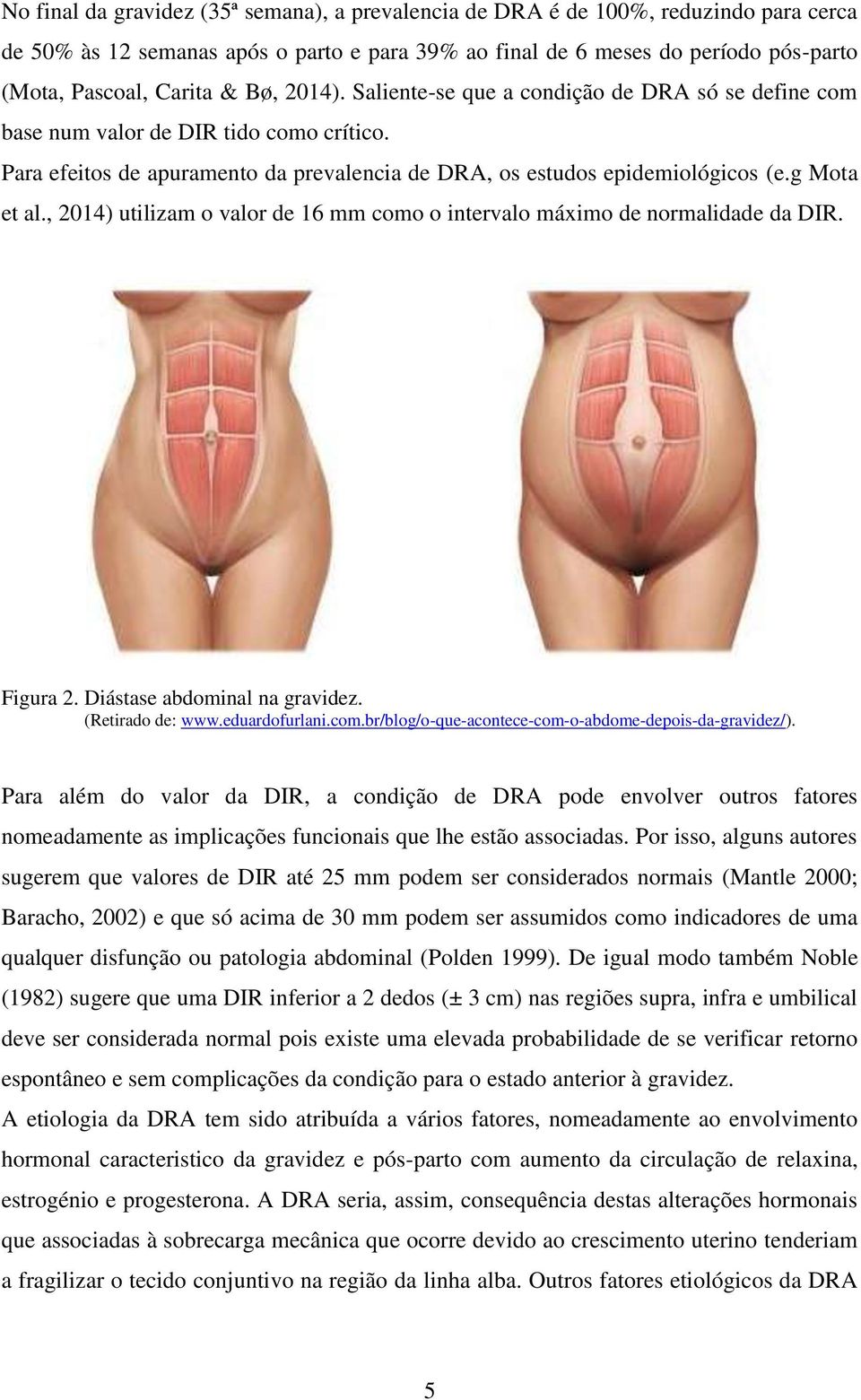 , 2014) utilizam o valor de 16 mm como o intervalo máximo de normalidade da DIR. Figura 2. Diástase abdominal na gravidez. (Retirado de: www.eduardofurlani.com.br/blog/o-que-acontece-com-o-abdome-depois-da-gravidez/).