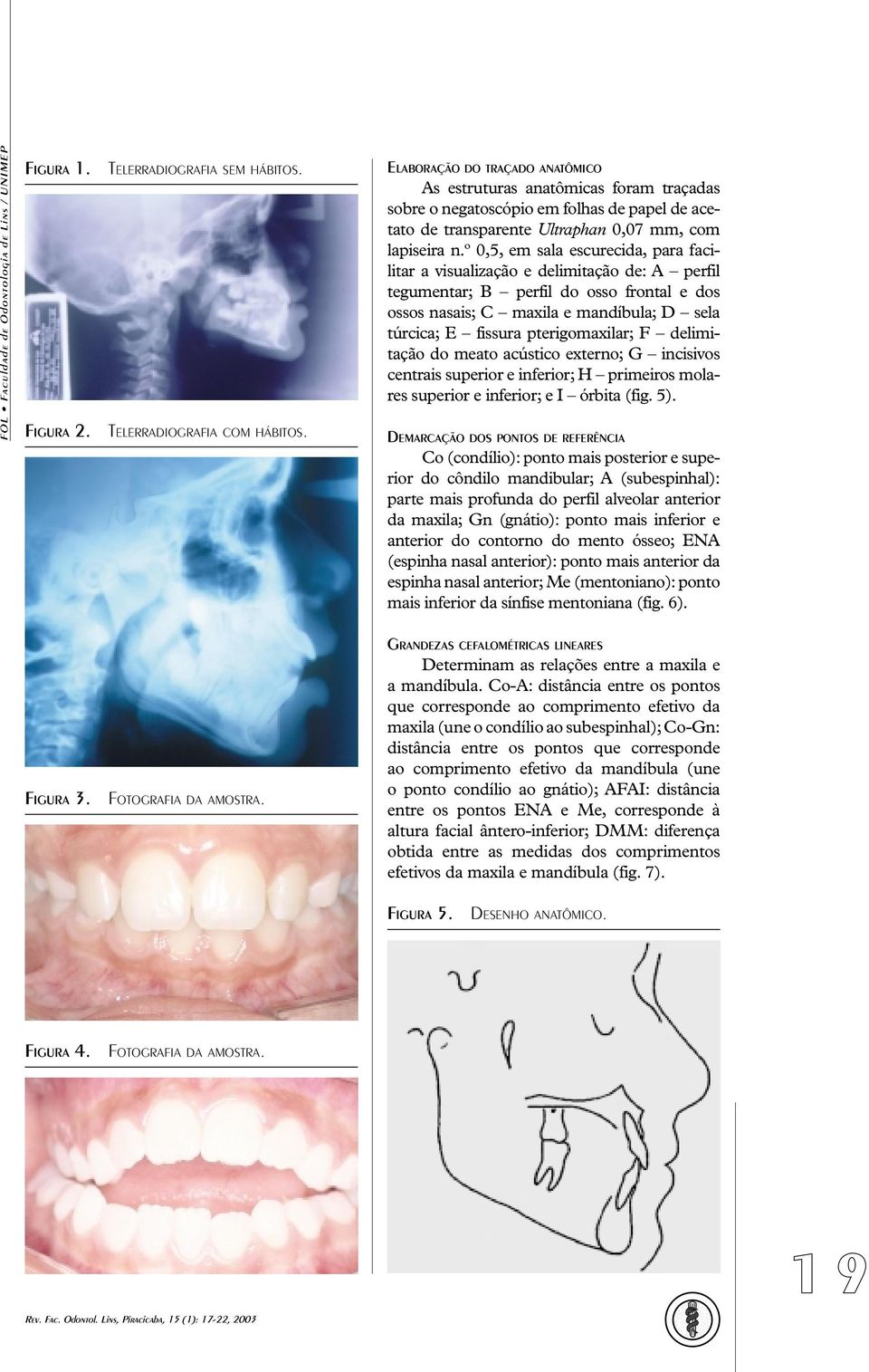 º 0,5, em sala escurecida, para facilitar a visualização e delimitação de: A perfil tegumentar; B perfil do osso frontal e dos ossos nasais; C maxila e mandíbula; D sela túrcica; E fissura