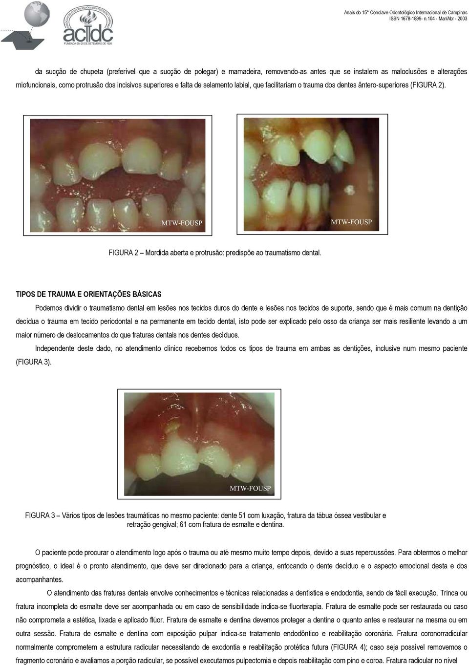 TIPOS DE TRAUMA E ORIENTAÇÕES BÁSICAS Podemos dividir o traumatismo dental em lesões nos tecidos duros do dente e lesões nos tecidos de suporte, sendo que é mais comum na dentição decídua o trauma em