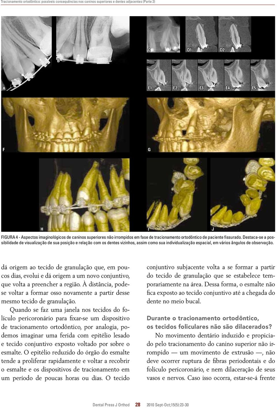 estaca-se a possibilidade de visualização de sua posição e relação com os dentes vizinhos, assim como sua individualização espacial, em vários ângulos de observação.