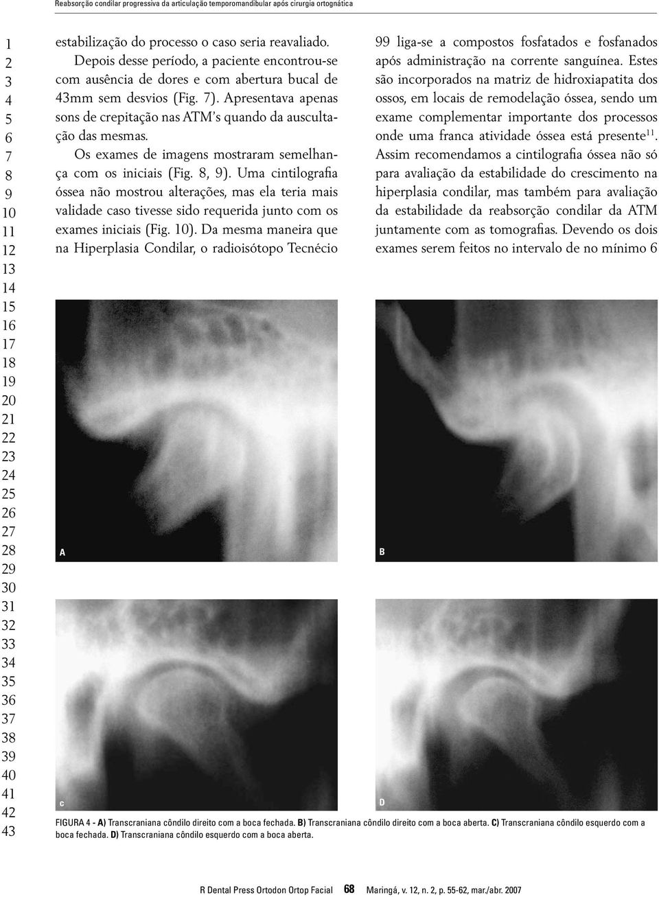 Apresentava apenas sons de crepitação nas ATM s quando da auscultação das mesmas. Os exames de imagens mostraram semelhança com os iniciais (Fig. 8, 9).