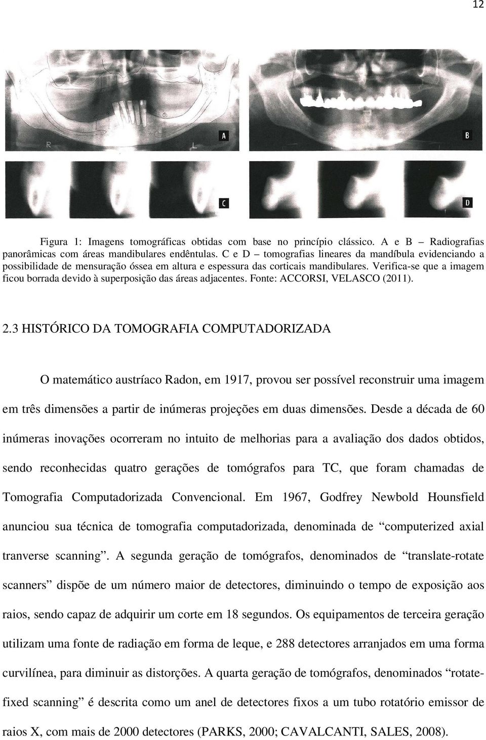 Verifica-se que a imagem ficou borrada devido à superposição das áreas adjacentes. Fonte: ACCORSI, VELASCO (2011). 2.