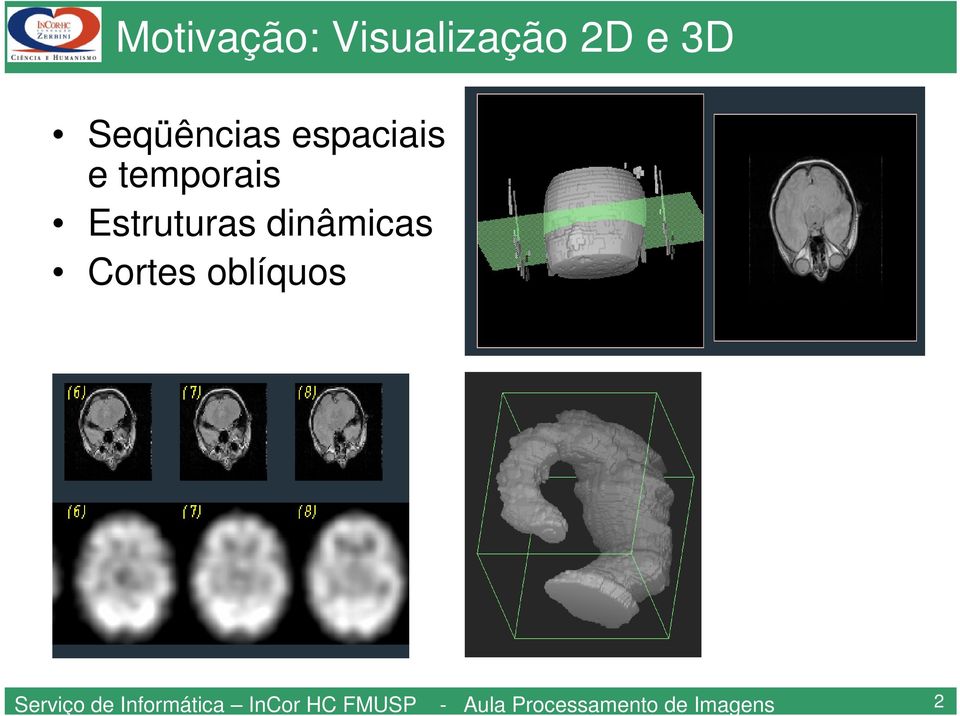 Cortes oblíquos Serviço de Informática