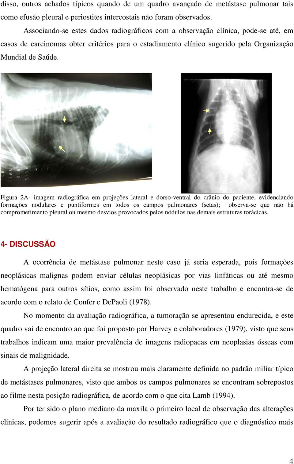 Figura 2A- imagem radiográfica em projeções lateral e dorso-ventral do crânio do paciente, evidenciando formações nodulares e puntiformes em todos os campos pulmonares (setas); observa-se que não há