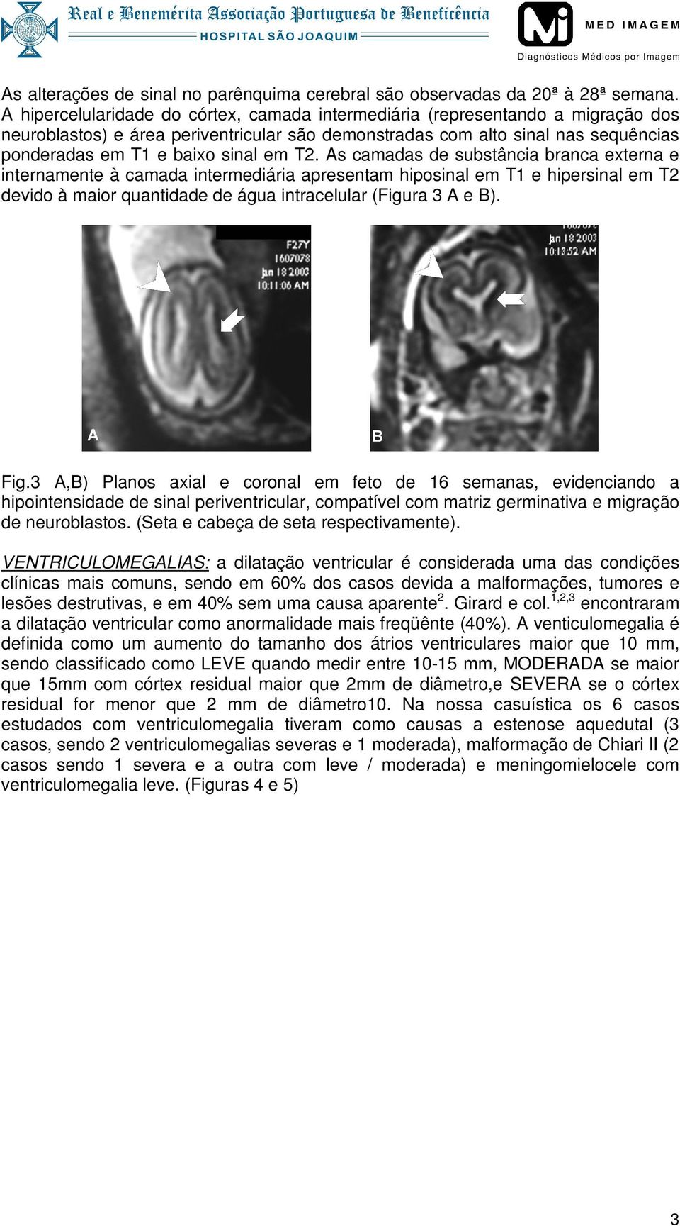 T2. As camadas de substância branca externa e internamente à camada intermediária apresentam hiposinal em T1 e hipersinal em T2 devido à maior quantidade de água intracelular (Figura 3 A e B). Fig.