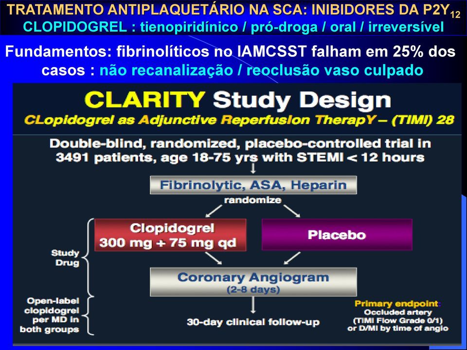 irreversível Fundamentos: fibrinolíticos no IAMCSST