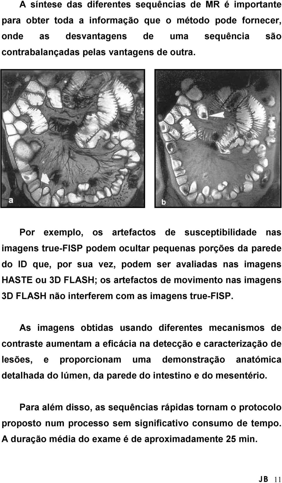 de movimento nas imagens 3D FLASH não interferem com as imagens true-fisp.