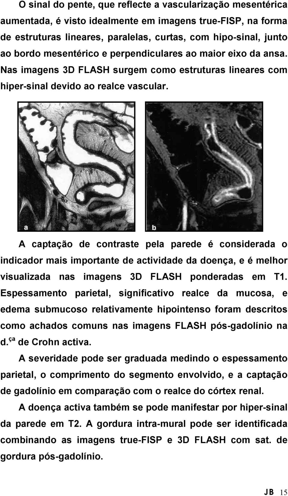 A captação de contraste pela parede é considerada o indicador mais importante de actividade da doença, e é melhor visualizada nas imagens 3D FLASH ponderadas em T1.