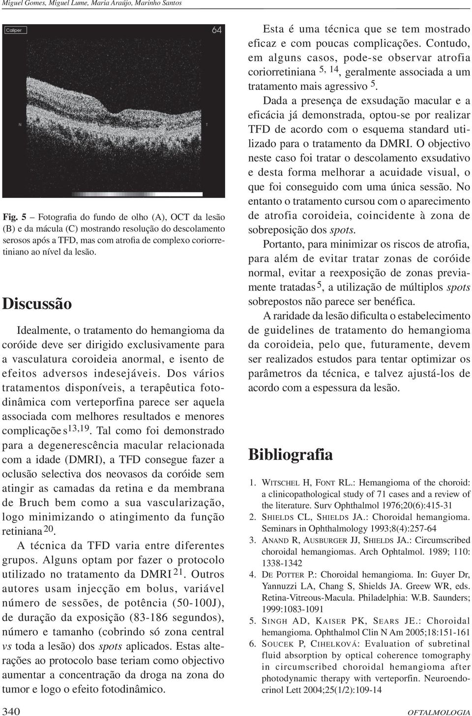 Discussão Idealmente, o tratamento do hemangioma da coróide deve ser dirigido exclusivamente para a vasculatura coroideia anormal, e isento de efeitos adversos indesejáveis.