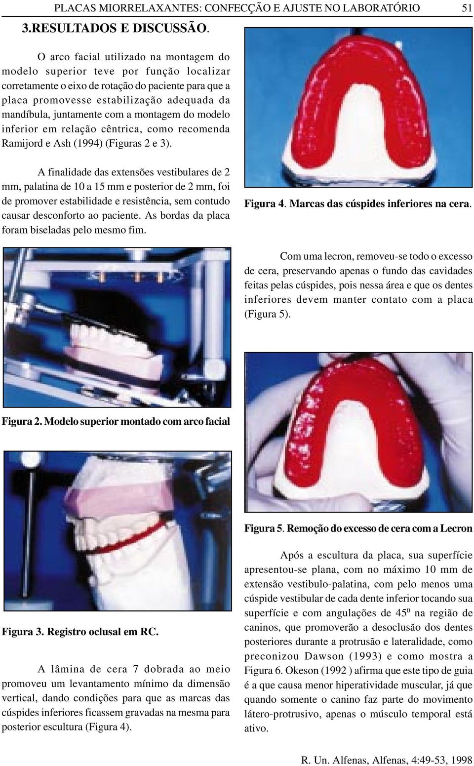 juntamente com a montagem do modelo inferior em relação cêntrica, como recomenda Ramijord e Ash (1994) (Figuras 2 e 3).