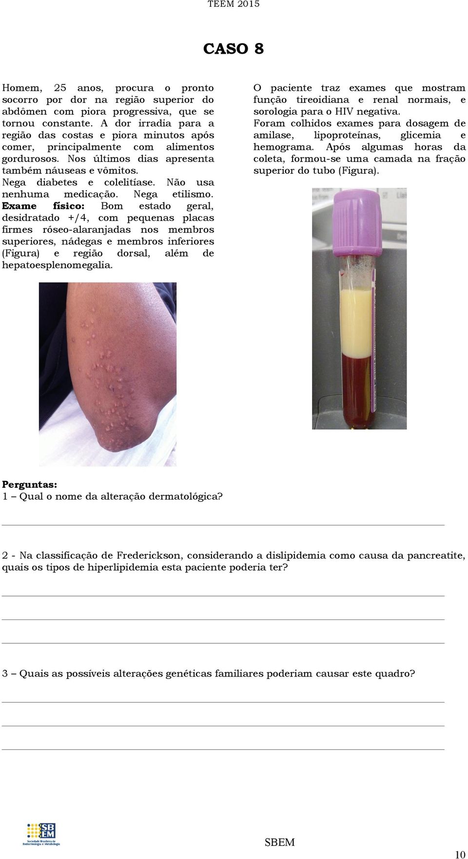 Não usa nenhuma medicação. Nega etilismo.