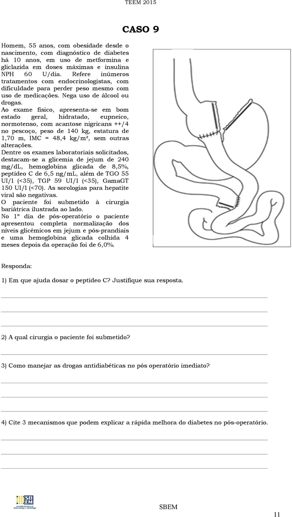 Ao exame físico, apresenta-se em bom estado geral, hidratado, eupneico, normotenso, com acantose nigricans ++/4 no pescoço, peso de 140 kg, estatura de 1,70 m, IMC = 48,4 kg/m², sem outras alterações.