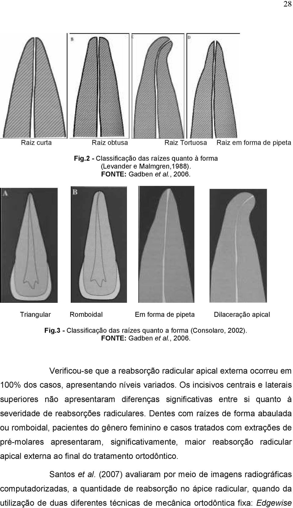 Verificou-se que a reabsorção radicular apical externa ocorreu em 100% dos casos, apresentando níveis variados.