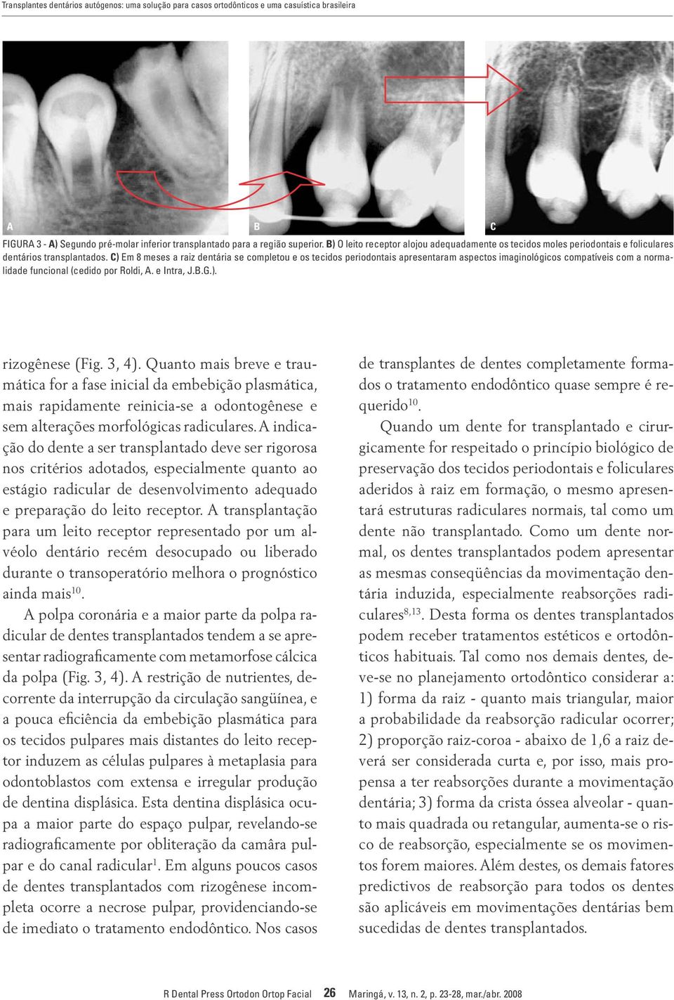 C) Em 8 meses a raiz dentária se completou e os tecidos periodontais apresentaram aspectos imaginológicos compatíveis com a normalidade funcional (cedido por Roldi, A. e Intra, J.B.G.). C rizogênese (Fig.