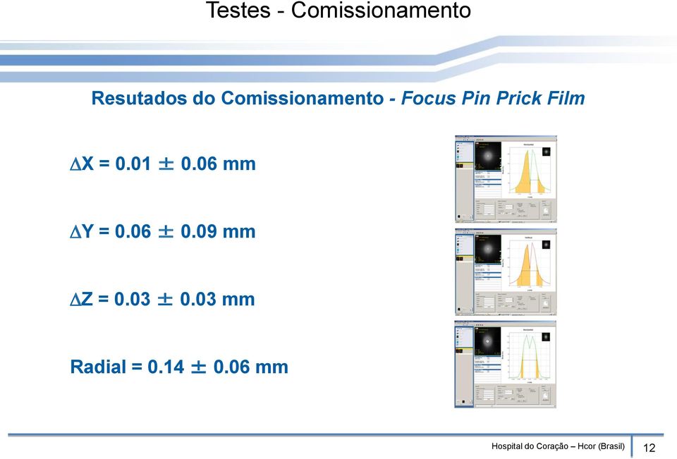 01 ± 0.06 mm Y = 0.06 ± 0.09 mm Z = 0.03 ± 0.